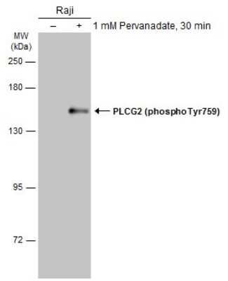 Western Blot: PLC-gamma 2 [p Tyr759] Antibody [NBP3-13241]